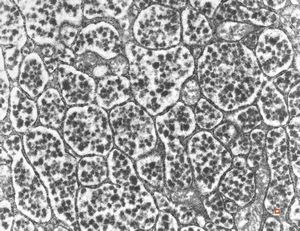 normal seromucinous salivary gland normal seromucinous salivary gland